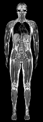 MRI-kuvaus koko ihmiskehosta